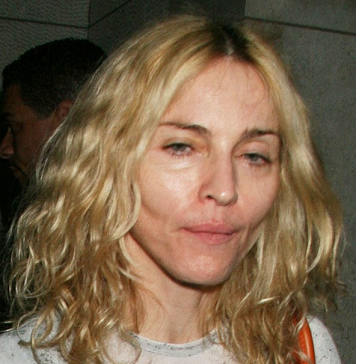 Madonna fucked up her face with plastic surgery 20080726.png